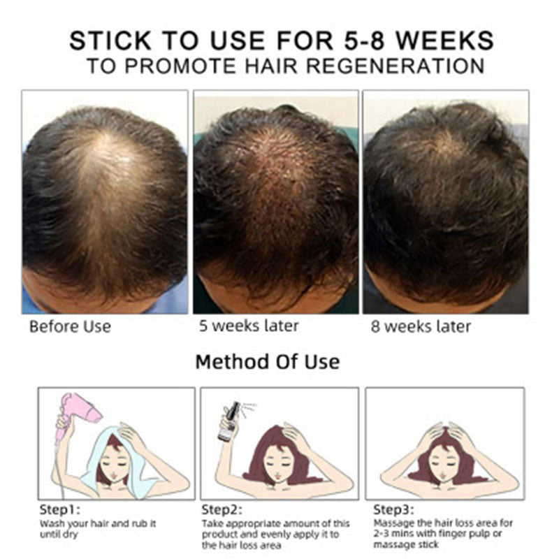 Hair Growth Oil with excellent results 100% Natural